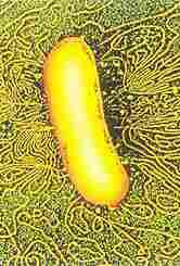 Escerichia coli
